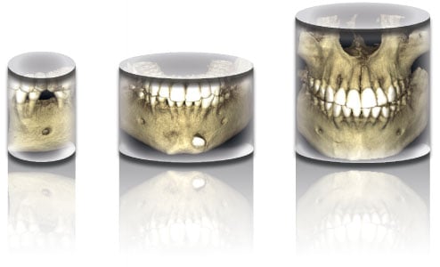 Three separate 3D image views graphic